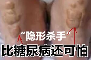 隱形殺手」高血脂的6大並發症，比糖尿病還可怕！