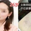 26歲美女教師結婚一年不忍家暴跳樓身亡！牙齒曾被打掉兩次……