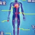 45歲1天透析5次還住進ICU，糖尿病不控制血糖的惡果