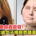 失戀舉槍自轟毀容！22歲女子換臉奇蹟重生