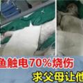 26歲青年釣魚觸電，全身燒傷70%，求父母，讓他安樂死