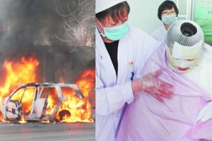 跟你們說這些東西千萬不要放車上，就是講不聽！真的爆炸了！愛開車的你一定要注意，這些生活用品快點丟出車外吧！太恐怖了！！