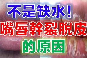 終於找到嘴唇老是「乾裂脫皮」的原因！原來不是缺水，應該要「這樣做」....趕快收藏吧