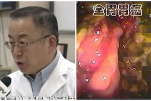 夫妻同患胃癌讓醫學界震驚！沒想到“胃癌會傳染”，更誇張的是“會傳染的癌”居然還有這一種．．．分享出去，終結癌症傳染吧！