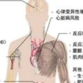 長期熬夜的後果，看了之後你還敢熬夜嗎