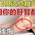 腿上出現這些「癥兆」，說明你的「肝腎都虛」了，不看後悔，及時去檢查吧！