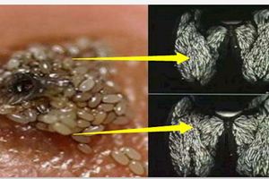 她天天都吃豬肉，最近出現了頭痛、大腿痛的癥狀還蔓延全身，檢查結果出來，主治醫生不停的搖頭...簡直太不可思議了！