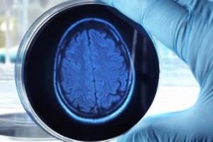 英國科學家找到方法跟「腦死的植物人」交談，問他「你這12年覺得痛嗎」回答令他們熱淚盈眶…