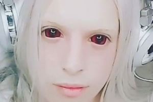 男子不聽父母勸解整容成精靈，當大家看到後都合影留念！