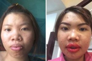 沒人敢娶的醜女「狠心花掉10萬整形變臉」，現在長這樣人生大逆襲還嫁給了富二代！