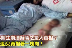婦科醫生崩潰辭職之驚人真相：引產胎兒竟捏著一塊肉！
