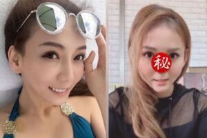 「太陽花女王」劉喬安吸毒鼻塌!首度公開毀容貌