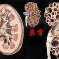 醫生叮嚀改掉這「7種習慣」他不聽，結果「腎臟」竟變成...快看你有沒有？！