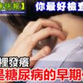 注意！身體這一出「發癢」可能血糖高了！出現這10種癥狀，是「糖尿病」的早期信號！你最好檢查一下！