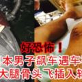 【好恐怖！】日本男子飆車遇車禍　右大腿骨頭飛[插·入]輪胎　