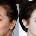 19個證明不必重新投胎也能「變臉重生」的韓國女人整形實際案例！