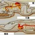 注意！你是「往左側睡」還是「往右側睡」？萬一選錯邊睡，就會「少活10年」...！