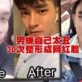 男嫌自己太醜30次整形成網紅臉