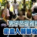 男子芭堤雅按摩-瘀血入肺部栓塞死