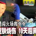 6歲童勇闖火場救爺爺90%皮膚燒傷10天後離世