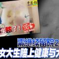 需繼續留院2周女大生賠上健康與大學考試