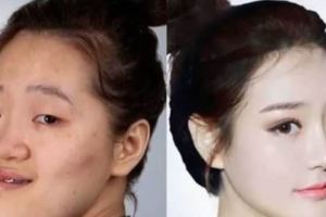 19個證明不必重新投胎也能「變臉重生」的韓國女人整形實際案例！
