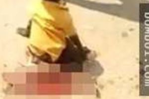 6歲男童過馬路時被卡車碾爆雙腿，腿上「只剩一層皮」讓人眼都哭紅了！