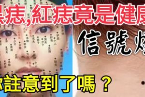 黑痣、紅痣竟是健康「信號燈」，你注意到了嗎？