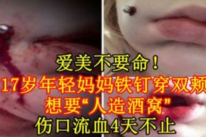 愛美不要命！17歲年輕媽媽鐵釘穿雙頰想要「人造酒窩」傷口流血4天不止【內附影片】