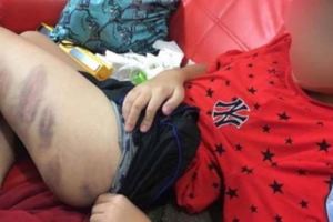 爸爸看了兒⼦「沒考到95分就遭前妻毒打」的傷勢嚇傻，接著老師的⼀⾏字證明他犯了⼤錯！