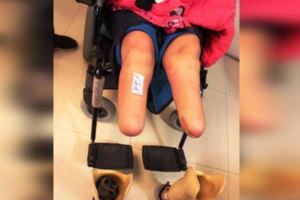 高中女遭性侵丟水溝…警當屍體不理！慘截肢又失明