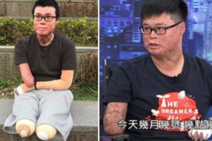 存活率僅剩5%，八仙塵爆傷者父母天天「笑著報時」救回兒子，原因超催淚！