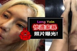 LengYein慘遭家暴照片曝光！16張駭人照片嚇到網民勁氣憤！