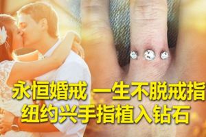 永恆婚戒一生不脫戒指紐約興手指植入鑽石