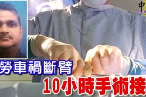 馬勞車禍斷臂10小時手術接回
