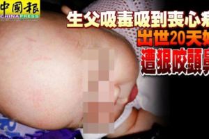 生父吸毒吸到喪心病狂出世20天娃兒遭狠咬頭鼻臉