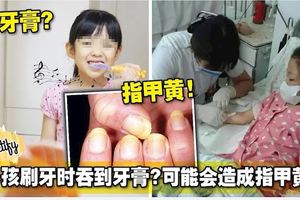 小孩刷牙時吞到牙膏？可能會造成指甲黃！