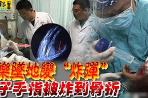 可樂墜地變「炸彈」男子手指被炸到骨折