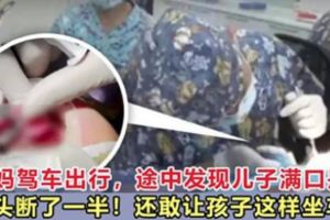媽媽駕車帶孩子出行，途中發現兒子滿口是血，舌頭斷了一半！
