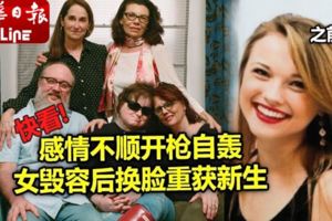 感情不順開槍自轟女毀容後換臉重獲新生
