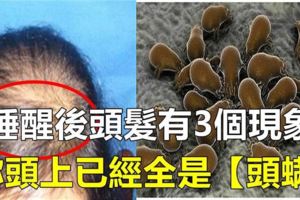早上起來，頭髮有這3個現象，說明你頭上全是【頭蟎】了