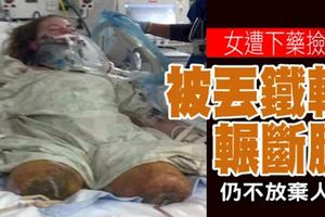 女遭下藥撿屍被丟鐵軌輾斷腿　仍不放棄人生