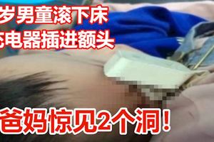 2歲男童滾下床「充電器插進額頭」爸媽驚見2個洞！