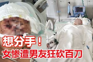 覺得男友不思上進想分手女慘遭狂砍百刀毀容命危