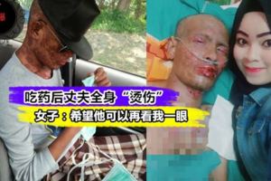 【不離不棄的真愛!!!】面對這樣的考驗不要抱怨，女子與丈夫的照片感動網民！女子：只希望他可以再見到我…