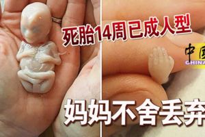 死胎14周已成人型媽媽不舍丟棄