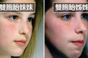 習慣嘴巴開開呼吸？　醫學研究「舌頭擺放位置」決定未來顏值！