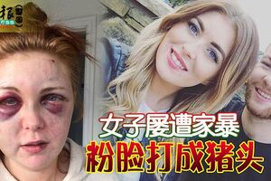女子屢遭家暴粉臉打成豬頭
