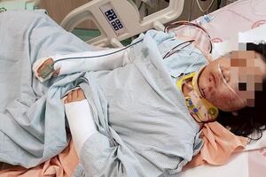 孩子參加學校暑期補救教學，卻被推下樓導致全身骨折脾臟撕裂，加害者卻若無其事回教室吃早餐