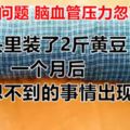 脖子出問題腦血管壓力忽高忽低，枕頭裡裝了2斤黃豆！一個月後，意想不到的事情出現了！